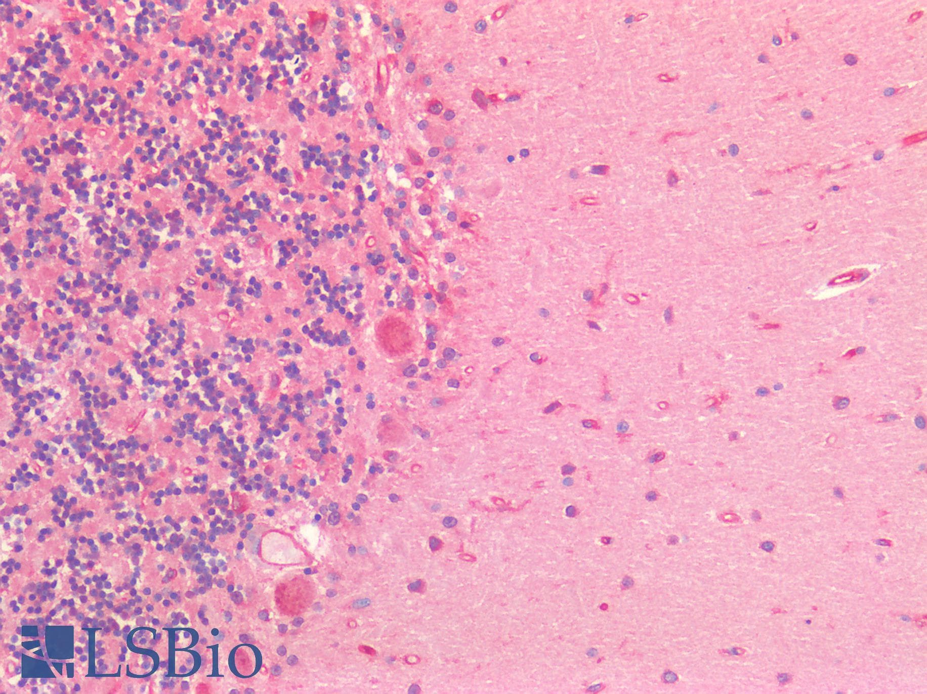 IHC-plus™ Polyclonal Rabbit anti-Human GAD1 / GAD67 Antibody (IHC)