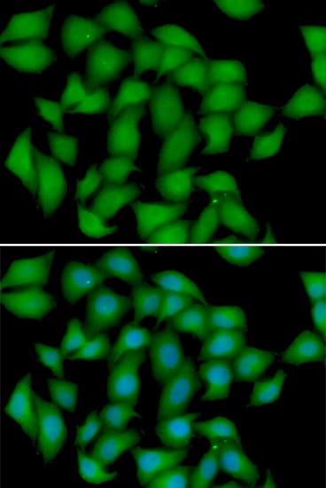 ATOX1 Antibody
