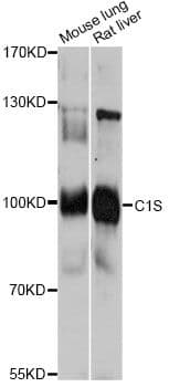 Complement C1s Antibody