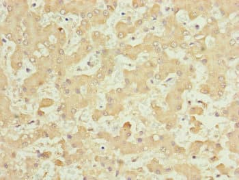 CDCA1 / NUF2 Antibody
