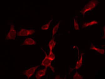 TKFC / DAK Antibody