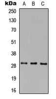 IHC-plus™ Polyclonal Rabbit anti-Human MAF1 Antibody (Internal, IHC, WB)