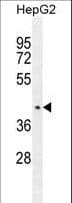 Polyclonal Rabbit anti-Human CCDC17 Antibody (aa481-509, IHC, WB)
