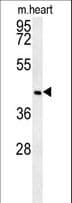 NPAL2 / NIPAL2 Antibody (aa57-86)