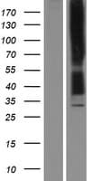 OPRK1 / Kappa Opioid Receptor Protein (Over-Expression Lysate Myc-DDK (Flag))