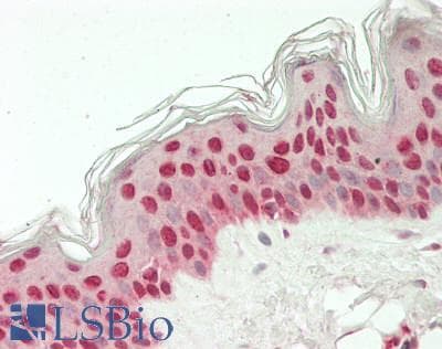 IHC-plus™ Polyclonal Rabbit anti-Human KLF4 Antibody (IHC, WB)