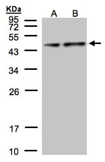 IHC-plus™ PDHA1 / PDH E1 Alpha Antibody (aa39-325)