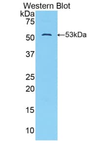 SLC2A14 Antibody (aa51-105, PE)