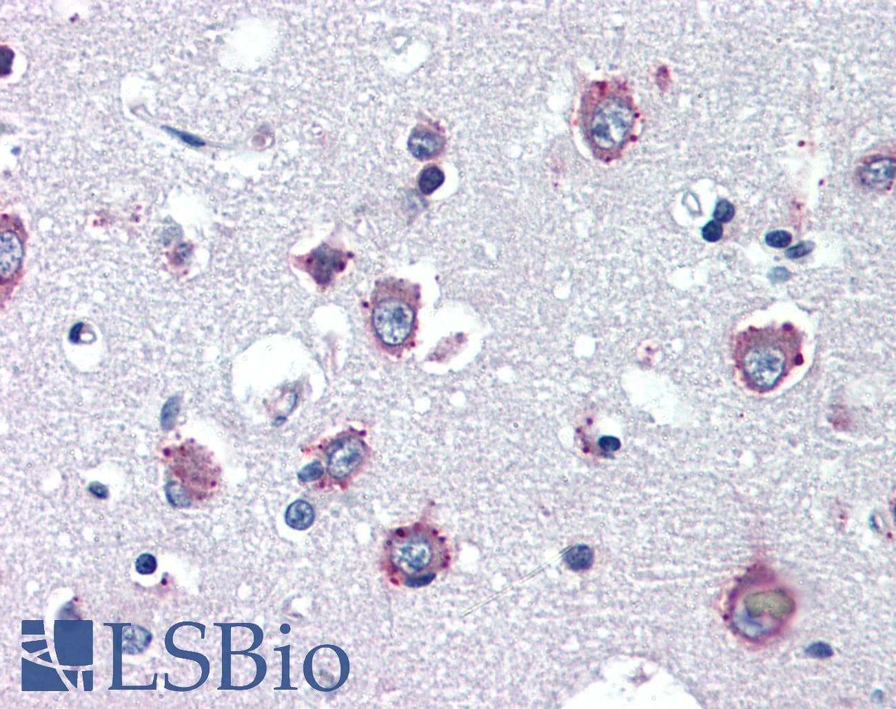 IHC-plus™ NPC / NPC1 Antibody (clone 17B5)