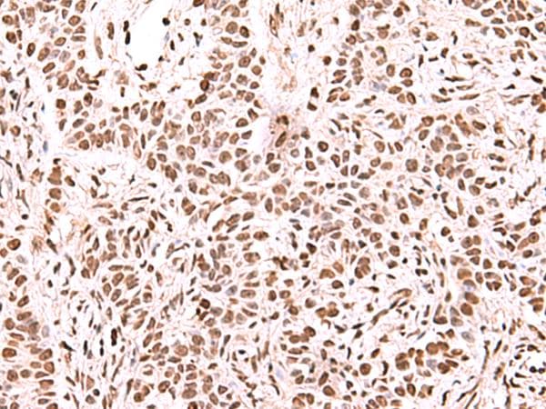 NASP Antibody