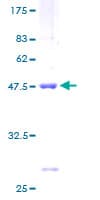 Human RPS10 / Ribosomal Protein S10 (Recombinant GST)