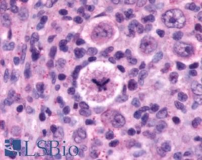 PathPlus™ Polyclonal Rabbit anti-Human CXCR4 Antibody (N-Terminus, IHC)