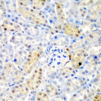 ADAD1 Antibody