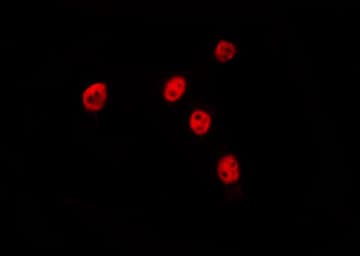POLR2J Antibody