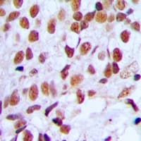 FOXK1 / MNF Antibody (C-Terminus)