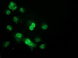 TP53 / p53 Antibody (clone OTI1D8)