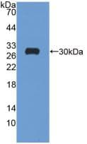 GSR / Glutathione Reductase Antibody (aa7-246, Biotin)
