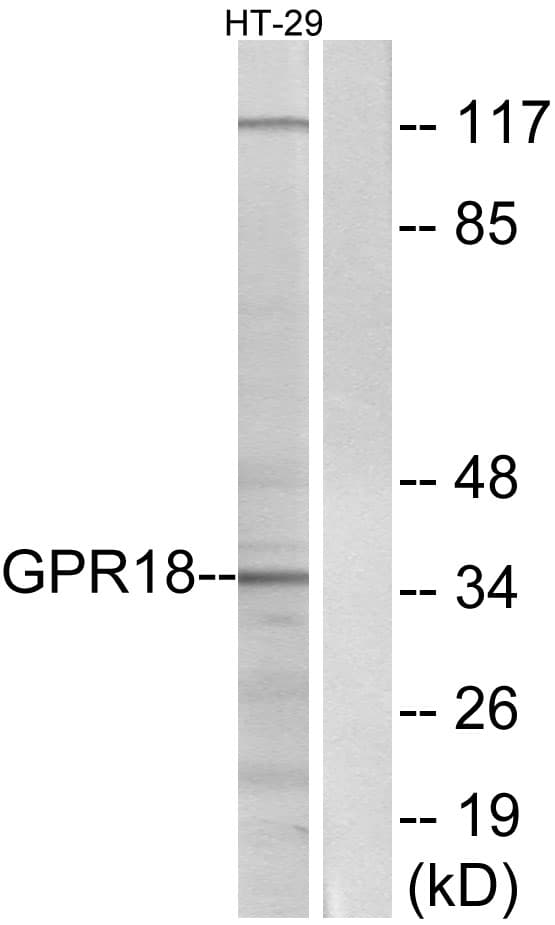 GPCRW / GPR18 Antibody (aa131-180)