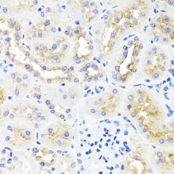 MNK / ATP7A Antibody