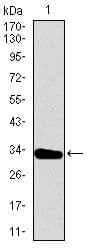 Monoclonal Mouse anti-Human TBXT / T / Brachyury Antibody (clone 1H9A2, Amino Acid: 257-309, IHC, WB)