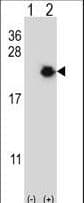 EIF4EBP1 / 4EBP1 Antibody (aa31-61)