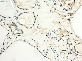 Monoclonal Mouse anti-Human MYC / c-Myc Antibody (clone OTI1A6, IHC, IF, WB)