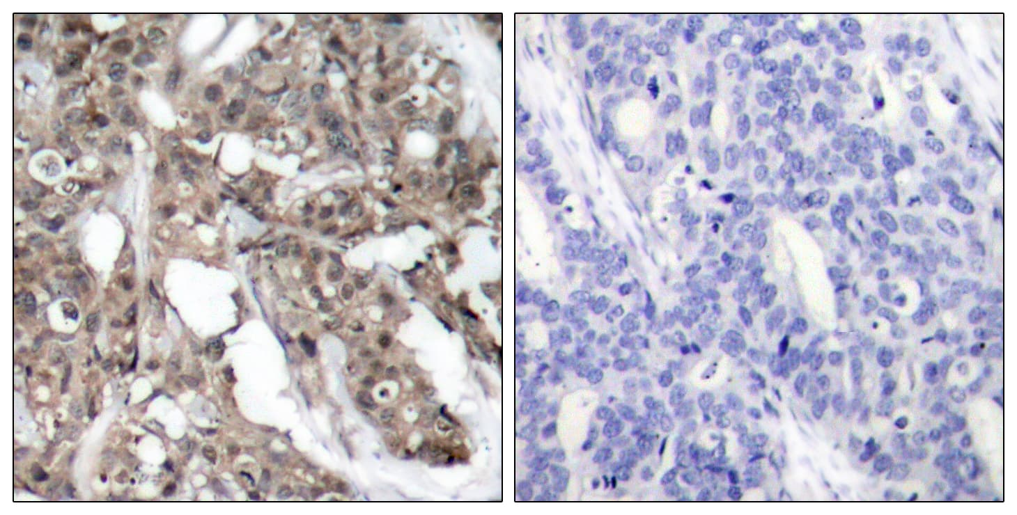 AKT1 + AKT2 Antibody (aa276-325)