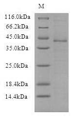 Vaccinia Virus VACWR090 Protein (Recombinant 6His, N-terminus)