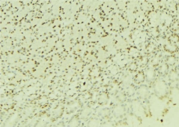 RBX1 / ROC1 Antibody