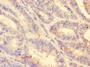 Polyclonal Rabbit anti-Human MMP2 Antibody