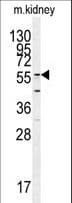 Polyclonal Rabbit anti-Human GADL1 Antibody (aa401-430, WB)