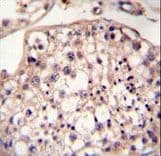 DYRK2 Antibody (aa105-135)