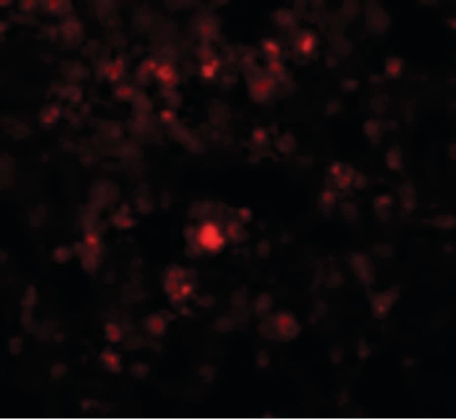 RHBDD2 Antibody