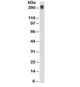 TAG-72 Antibody (clone CC49)
