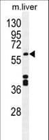 Polyclonal Rabbit anti-Human CYP1A2 Antibody (aa255-282, IHC, IF, WB)