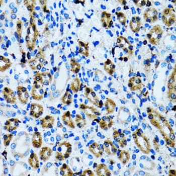 Polyclonal Rabbit anti-Human NOL3 / ARC Antibody (IHC, IF, WB)