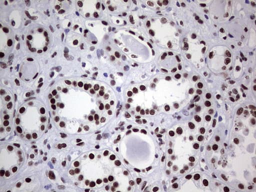 Monoclonal Mouse anti-Human PPP1R8 / Rnase E Antibody (clone OTI4E5, aa1-225, IHC, WB)