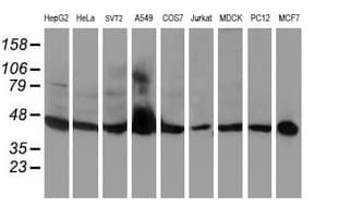 IHC-plus™ Monoclonal Mouse anti-Human APMAP / C20orf3 Antibody (clone OTI4F6, IHC, WB)