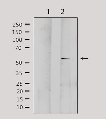 MMP1 Antibody