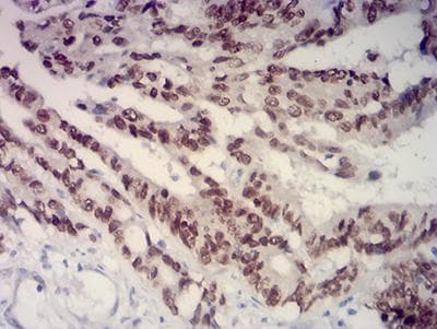 Monoclonal Mouse anti-Human SATB2 Antibody (clone 7B2C4, IHC, WB)