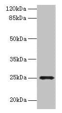 Polyclonal Rabbit anti-Human FGFBP2 Antibody (aa20-223, IHC, WB)