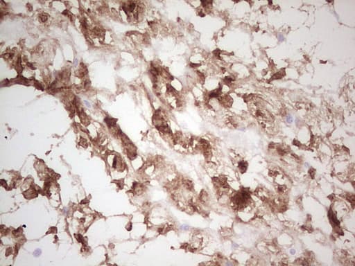 CSNK1G1 / CKI-Gamma 1 Antibody (aa163-422, clone OTI1C5)