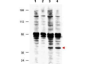 IHC-plus™ Polyclonal Rabbit anti-Human FANCF Antibody (Internal, IHC, WB)
