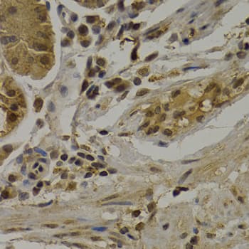 UMPS / OPRT Antibody