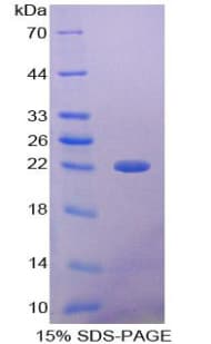 Rat AMBP Protein (Recombinant 6His, N-terminus)
