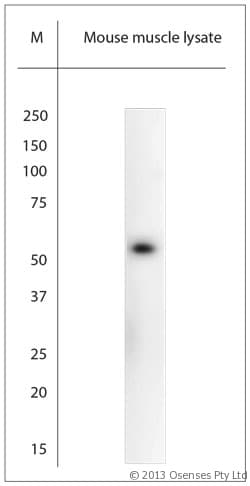 ACCN3 / ASIC3 Antibody (aa500-531)