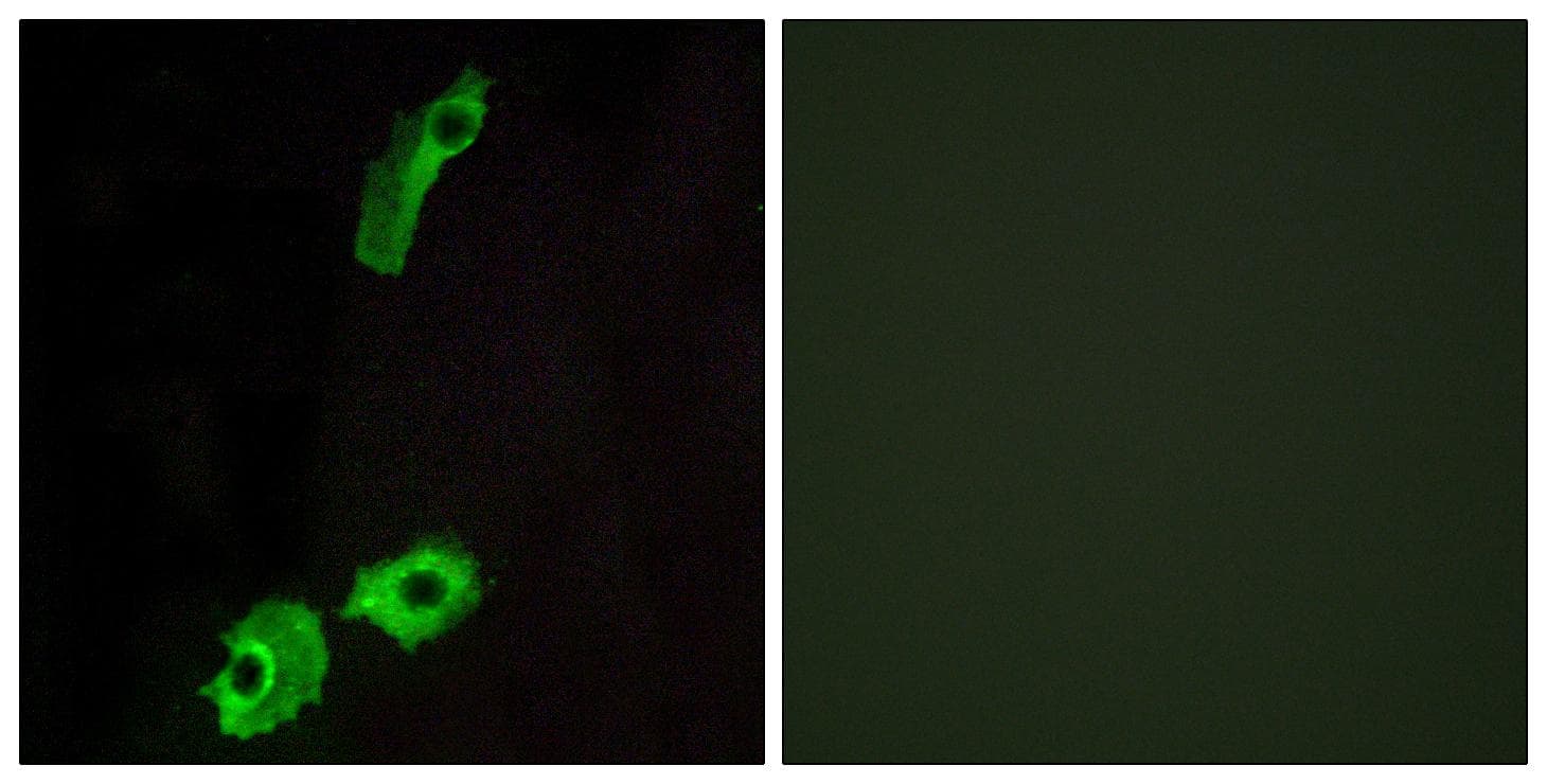 GPR151 Antibody
