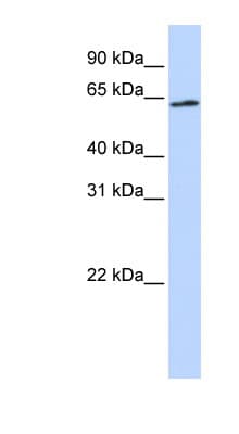 AIFM3 Antibody (aa216-265)