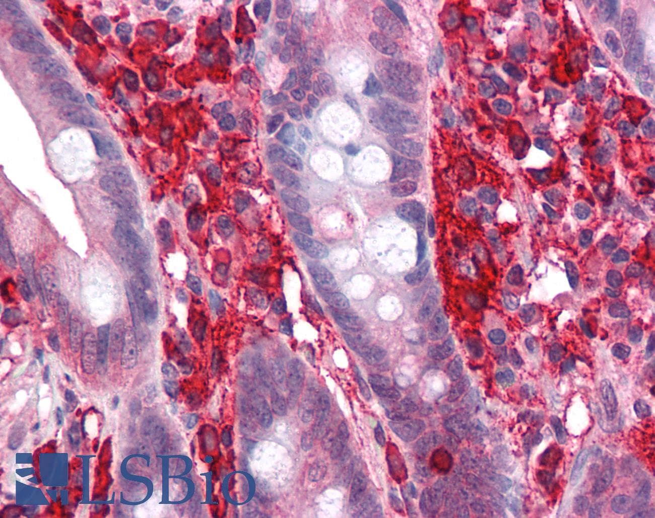 IHC-plus™ APCL / APC2 Antibody