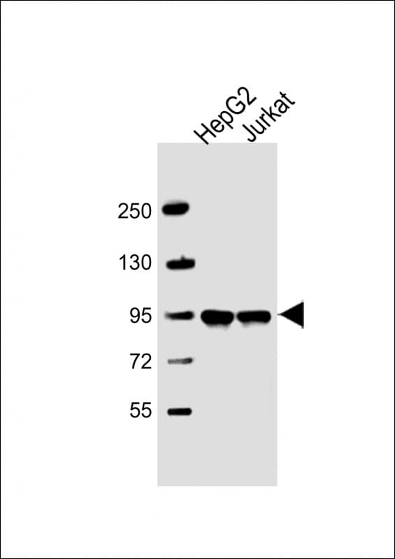 IHC-plus™ PPFIBP1 Antibody (aa588-617)